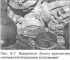 Timing Chain Cover — Removal and Installation
