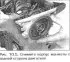 Crankshaft — Removal
