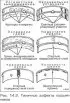 Main and connecting rod bearings — checking condition
