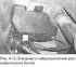 Fuel system expansion tank — removal and installation