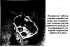 Determination of the thickness of the intermediate shaft adjusting rings